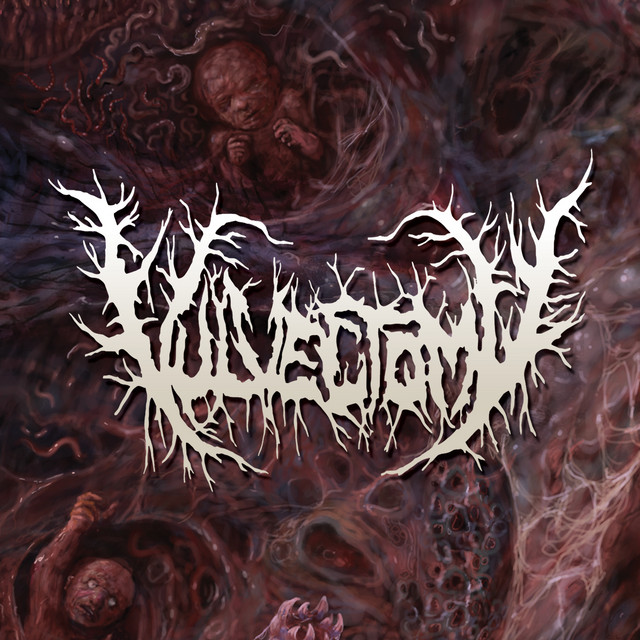 Vulvectomy
