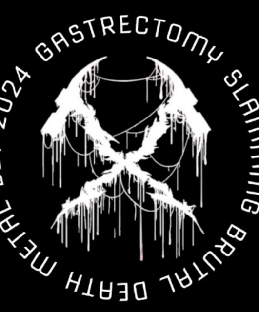 Gastrectomy