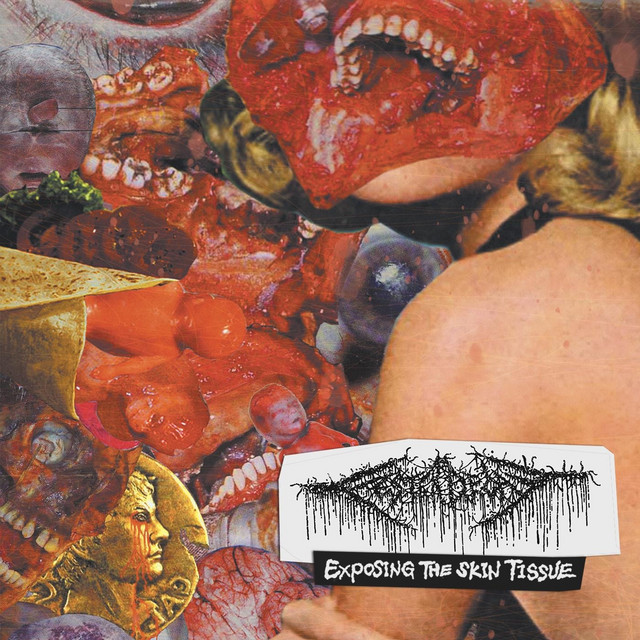 Exposing the Skin Tissue
