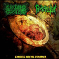 Chronic Mental Diarrhea